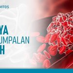Cara Mencegah Penggumpalan Darah Saat Perjalanan Jauh: Panduan Lengkap untuk Perjalanan Aman