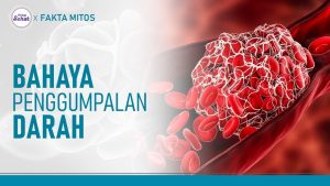Cara Mencegah Penggumpalan Darah Saat Perjalanan Jauh: Panduan Lengkap untuk Perjalanan Aman