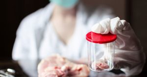 Menguak Masa Depan Pangan Apa Itu Daging Berbasis Laboratorium Dan Apakah Aman