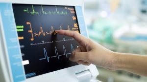Pentingnya Tes Ekg Untuk Cek Kesehatan Jantung Memahami Deteksi Dini Gangguan Jantung