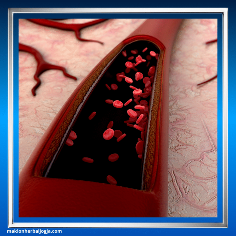 Risiko Merokok Terhadap Penyempitan Arteri Ancaman Senyap Bagi Kesehatan Jantung Dan Pembuluh Darah